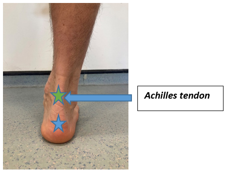 Achilles Tendinopathy Belfast Health Social Care Trust website